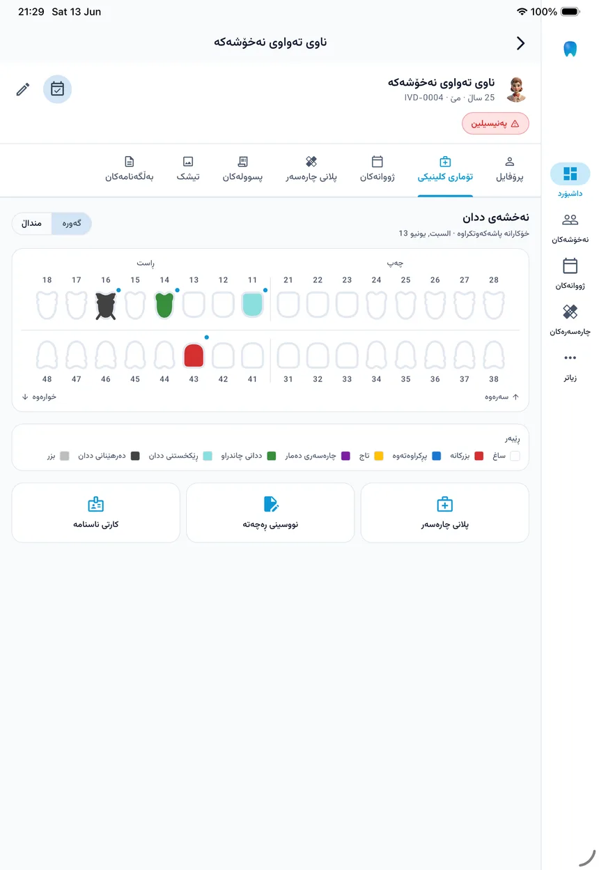 ايفورا — ئایپاد