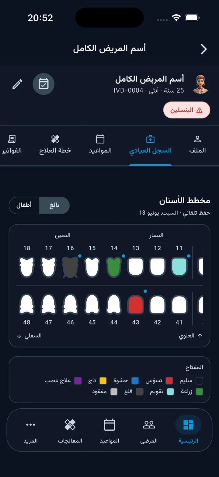 ايفورا — آيفون
