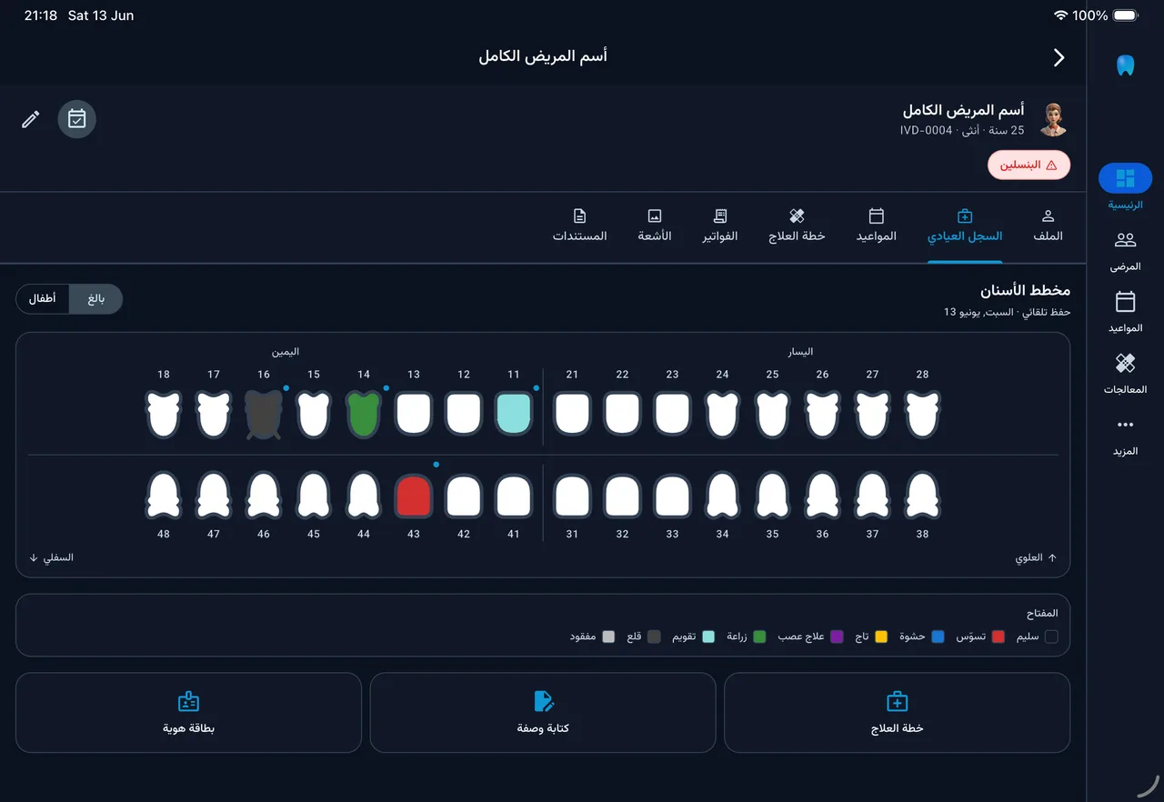 ايفورا — web