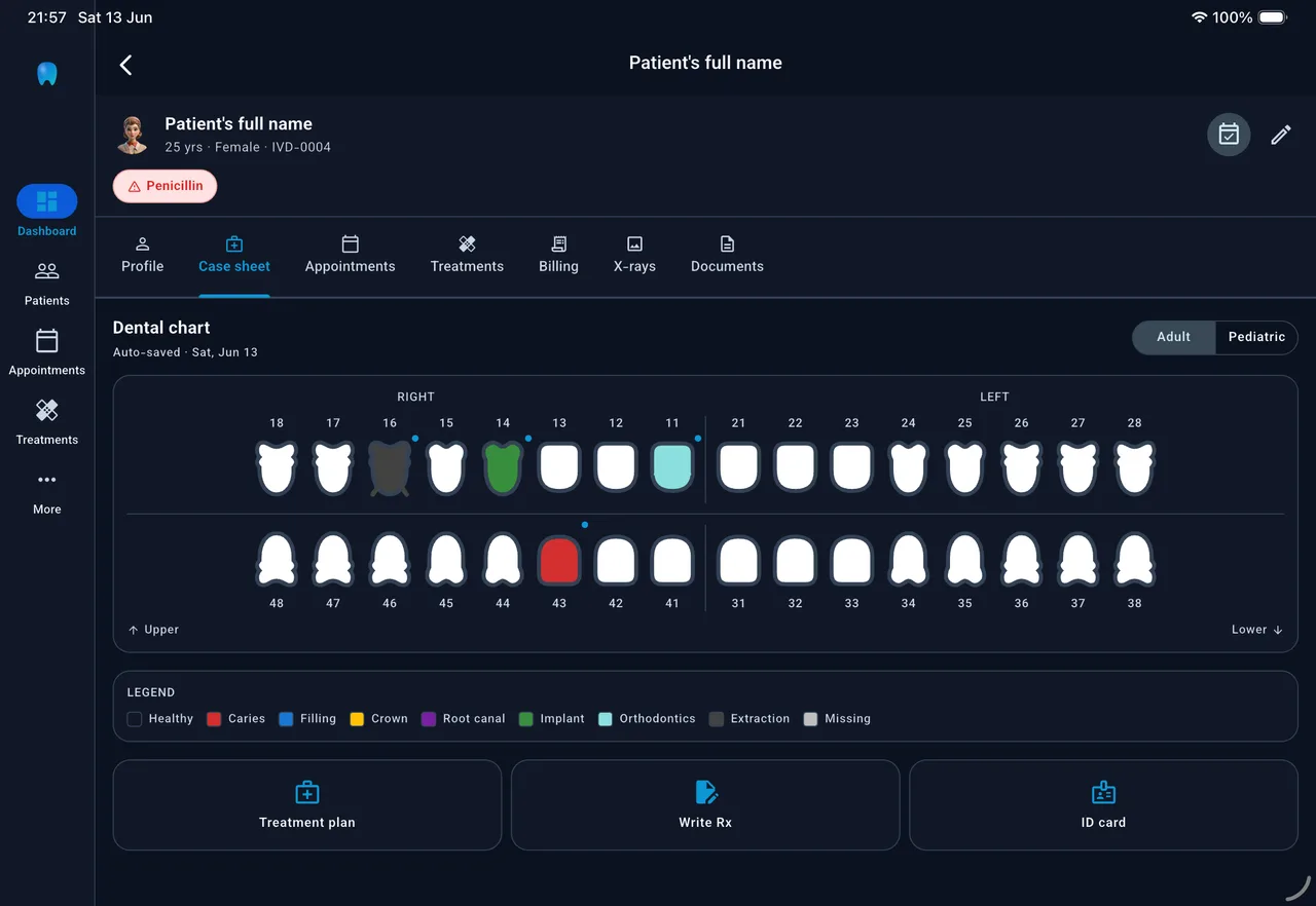 ايفورا — web